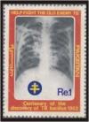 Colnect-887-095-Chest-x-ray-of-infected-person.jpg