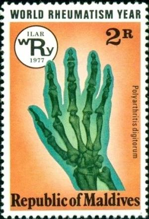 Colnect-4556-799-Rheumatic-hand.jpg